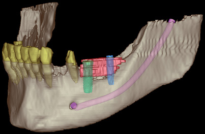 Digitale, 3-dimensionale Diagnostik